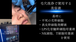 KIWAMI ポセイドン　毛穴洗浄で使用する専用美容液